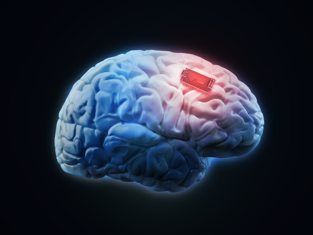 Implant cerveau